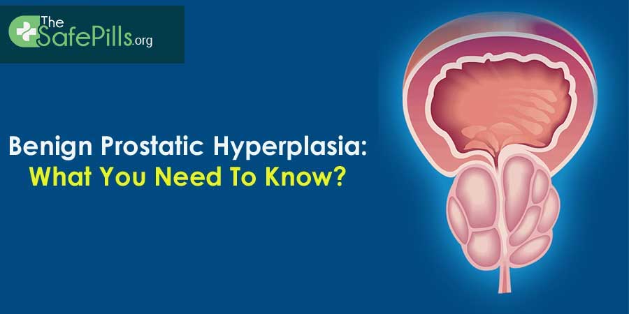 Know About Benign Prostatic Hyperplasia