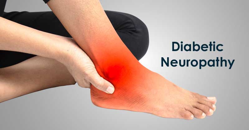 Diabetic Neuropathy- Know Its Symptoms and Causes