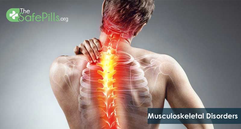 Musculoskeletal Disorders: Here Is An Inclusive Guide 